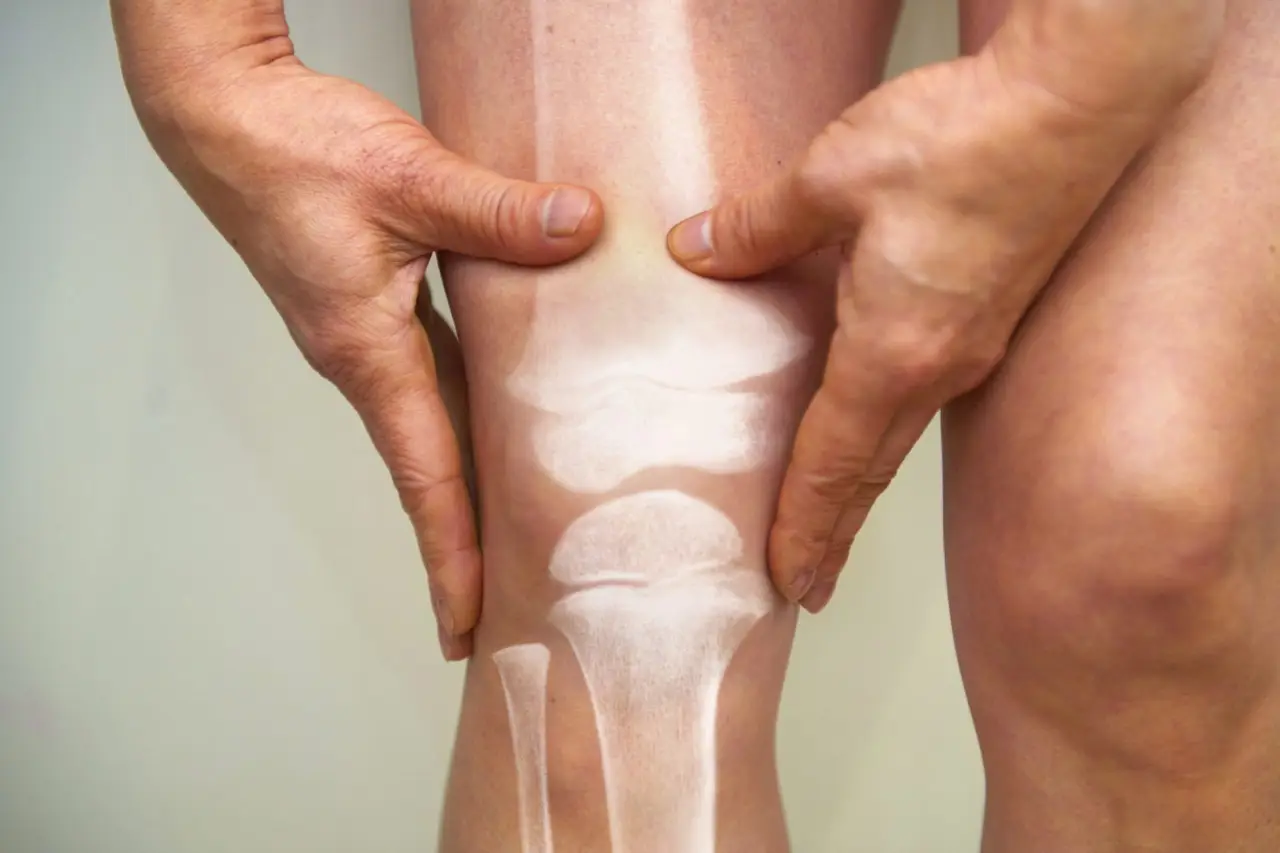 5 segnali che le tue ossa hanno bisogno di attenzione: come riconoscerli in tempo secondo l'osteopata 5 segnali che le tue ossa hanno bisogno di attenzione: come riconoscerli in tempo secondo l'osteopata